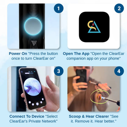 Orion™ Earwax Removal Kit
