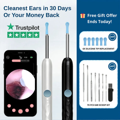 Orion™ Earwax Removal Kit